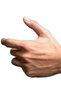 Depilación Láser Manos y dedos