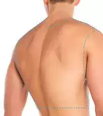 Depilacion-laser-Hombre-espalda
