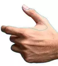 Depilacion-laser-Hombre-manos-y-dedos