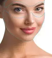Depilacion-laser-rostro-completo